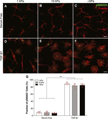 Signaling Downstream of Focal Adhesions Regulates Stiffness-Dependent Differences in the TGF-β1-Mediated Myofibroblast Differentiation of Corneal Keratocytes